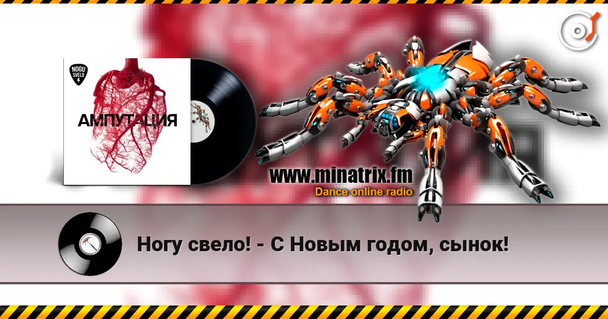 Ногу свело! - С Новым годом, сынок! жоғары сапада онлайн тыңдау | Minatrix.FM